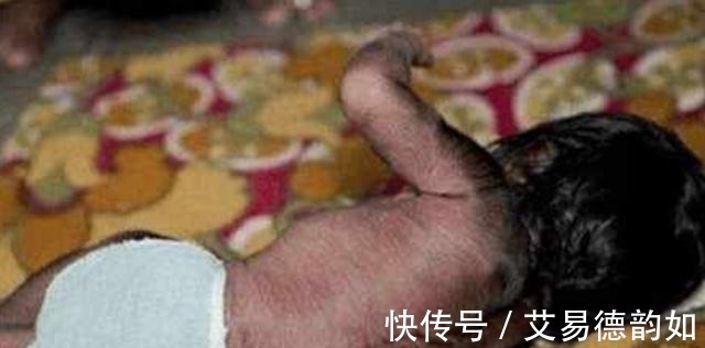 小玲|95后10月怀胎生下“孙悟空”，看到孩子模样，产妇大叫快扔掉