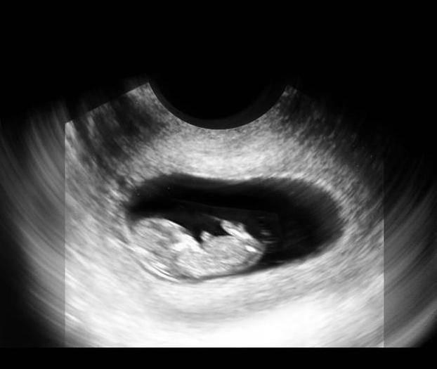 性别|胎儿从卵泡到性别形成,17张图片清晰诠释,男宝女宝看得很清楚