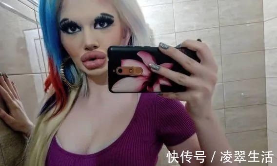 sofia 21次丰唇手术之后，这个妹子的嘴唇现在长这样…