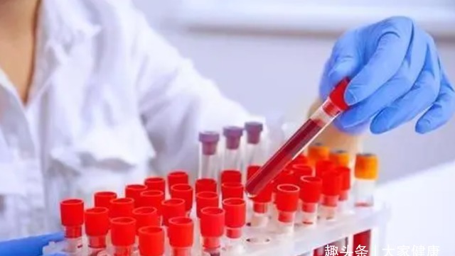 检查|血常规到底能不能检查出癌症?这3个指标有异常,要做详细检查!