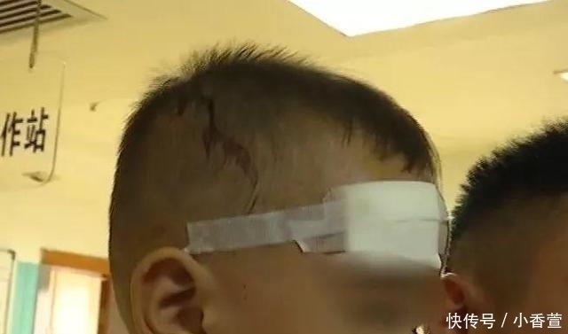 满脸|吓坏家长! 孩子早上起来满脸是血, 医生 已收治十多名同情况小孩