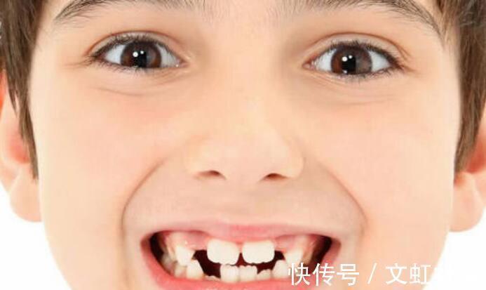 双排牙|最全儿童换牙时间表：儿童换牙何时开始、何时结束？一图说清