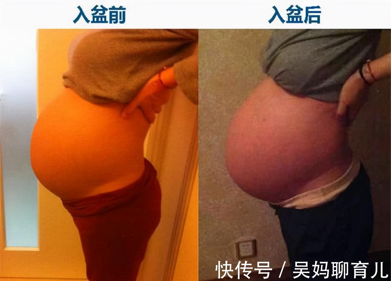 怀孕|胎儿入盆你是否了解?把握几个细节,轻松应对胎儿入盆