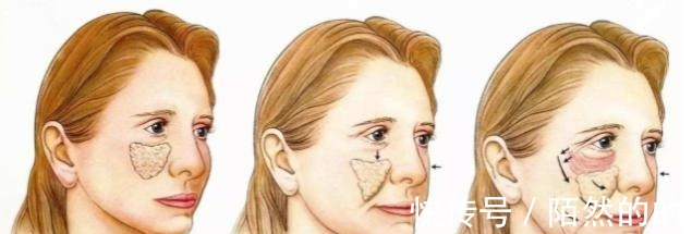 面部轮廓 医美科普|年过40岁的女性,拿什么对抗面部轮廓的整体衰老!