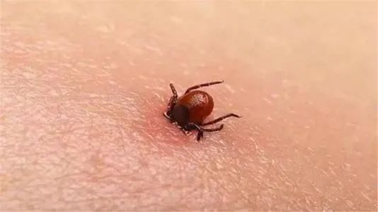 温州|温州一8岁女孩发烧休克，原来是被这种雨季最为活跃的虫子咬了