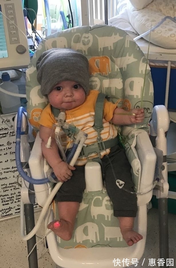 宝宝|宝宝患有罕见疾病,自出生一来就没出过医院