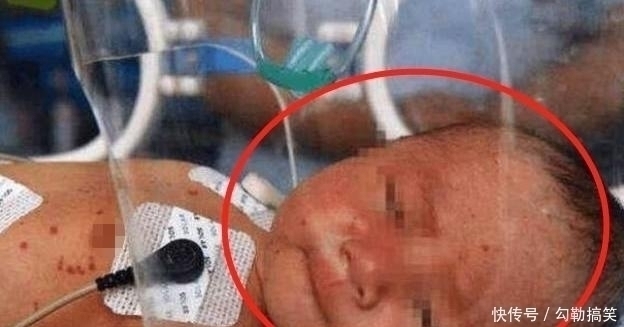 双拳|宝宝出生5天后紧握双拳离世，婆婆好奇掰开小手，宝妈泣不成声