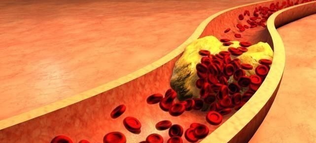 脂类物质|每天吃山楂可以降血脂?清华教授:大错特错,真正降血脂的是这件事