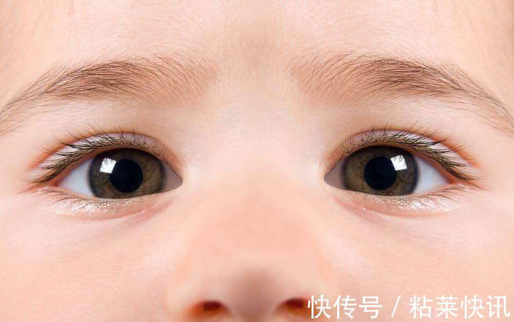 揉眼睛|宝宝经常揉眼睛,家长别不当回事,有可能跟以下2种疾病有关
