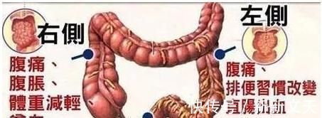 大便|正常人一天应该排几次便若在此次数内，恭喜，肠道很健康