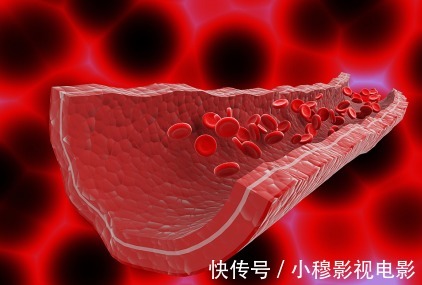 原发性高血压|高血压的三大误区，医生提醒：别再犯傻了，想要稳定血压像这样