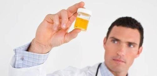 尿酸|高尿酸不用怕,常吃这些食物,尿酸回归正常,痛风“绕道走”