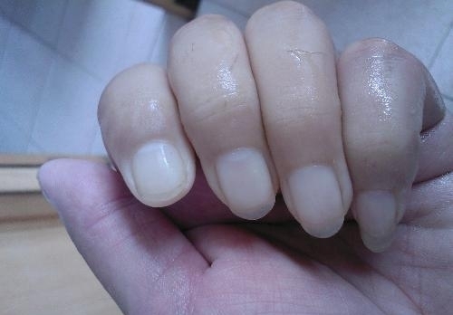 脸色苍白|寿命短的人,可能身上有4处发白,若占1个不占,恭喜容易长寿