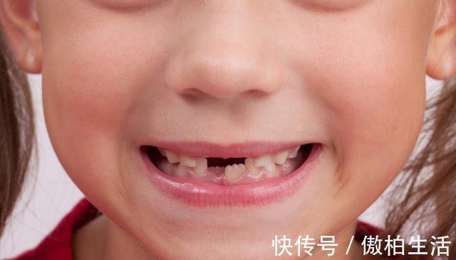 晚点|家长知道孩子换牙时间吗？不要大意了，做好这几点让孩子牙齿变好