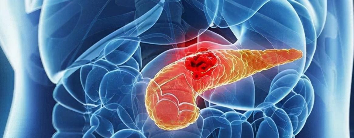 生活方式|从起病到死亡，得了糖尿病是怎样一种体验？