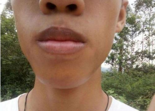 肝不好，身体会出现3黑2疼，医生直言：小心肝硬化找上门