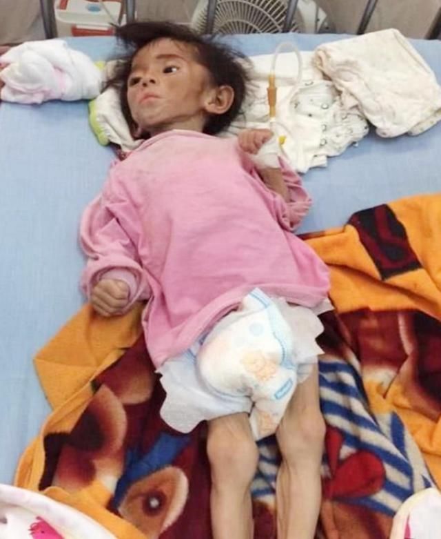 孕妇|小孩因病被父母遗弃饿成皮包骨,被网红收养后,现在怎样了