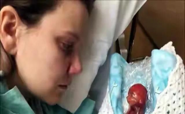 天不遂人愿|还记得14年前那个拇指姑娘吗出生只有24厘米,现状让人欣慰