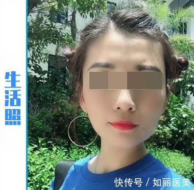 周女士 45岁女士拉皮手术便签记录“曝光”,脸好像小了一圈