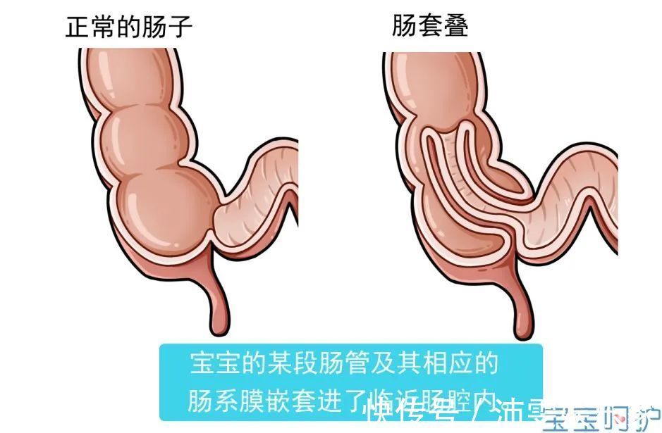 灌肠|心痛!7月龄宝宝灌肠后死亡,一生病就灌肠,真的就是在害他!