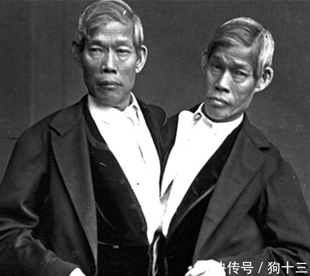 连体婴儿|连体兄弟也能暴富?娶英国姐妹,四人同床竟生下22个孩!
