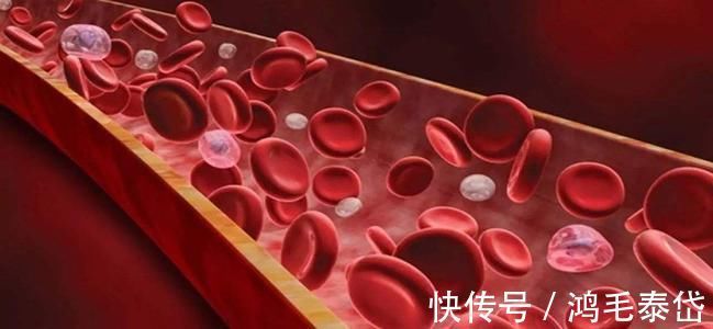 降血脂|血脂高吃什么?降血脂有5个“猛将”!爱吃2种以上,血管感谢你