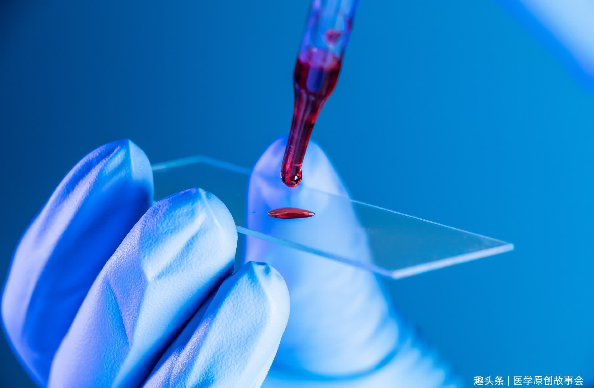 o型血|血型决定寿命？A型、B型、O型、AB型，哪种癌症发生率最高？