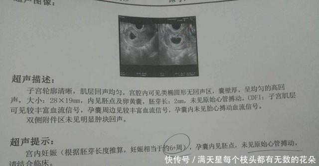 孕妈|怀孕42天发生“胎停”,孕早期这5大禁忌,新手孕妈一定要守住