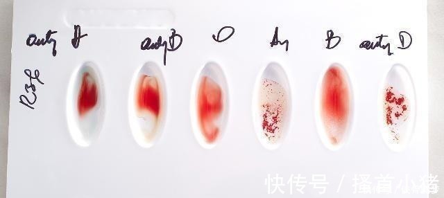 受孕|孕妇是这个血型，你和孩子都有福气，但第一胎尽量别打掉