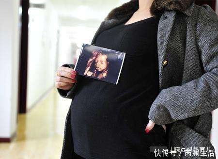 畸形|四维彩超能够预防胎儿畸形吗？四维彩超真正有6个作用，别搞错