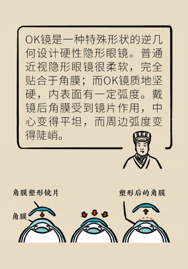 嗖嗖|孩子近视度数嗖嗖地涨，戴OK镜真能缓解近视吗？
