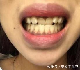 牙膏到底沾不沾水 很多人都弄错了, 难怪满口黄牙还臭!