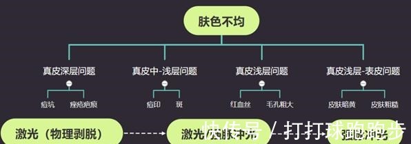 滤片 美莱光子嫩肤和激光种类这么多,到底怎么选!