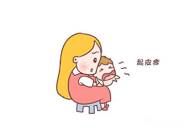 夏季|夏季皮肤大作战，痱子湿疹统统拿下！