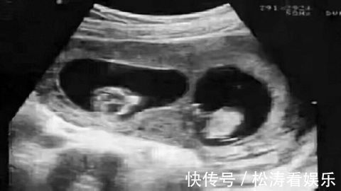 高端大气上档次|夫妻生娃DNA检测却是“叔叔”的,可爸爸是独生子!真相令人目瞪口呆