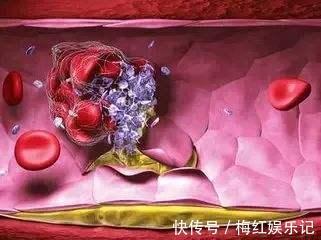 延长寿命|对于老人是“生命在于运动”，还是“静止使人长寿”？要尊重科学