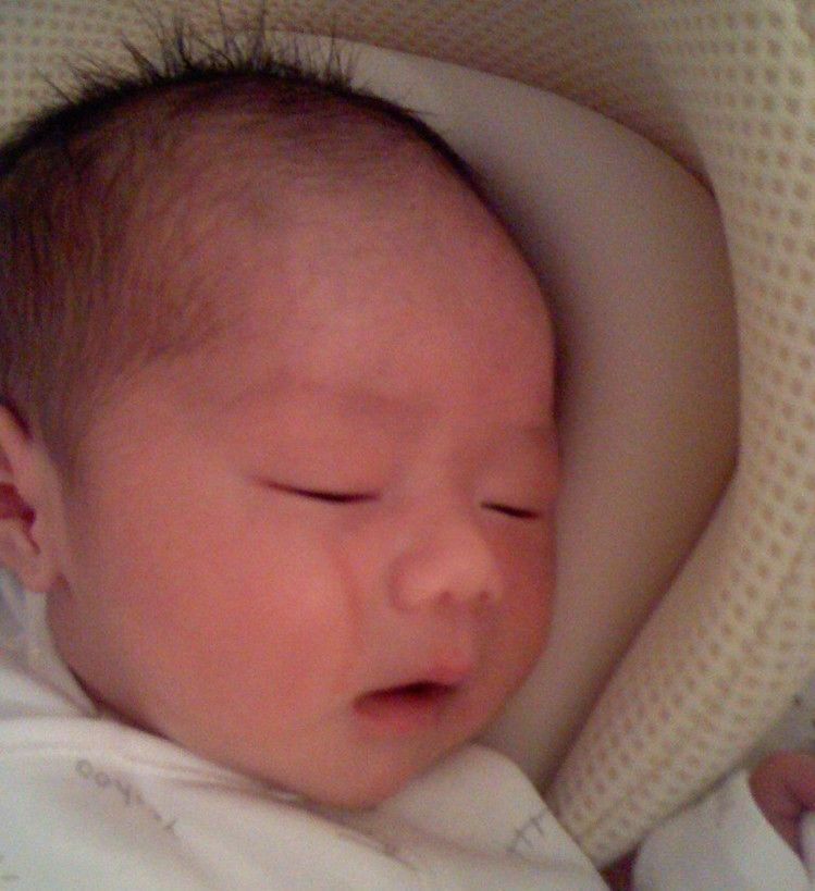 导致孩子|孩子1岁脸上“产钳印”不消,找医生被反驳,宝妈无言以对