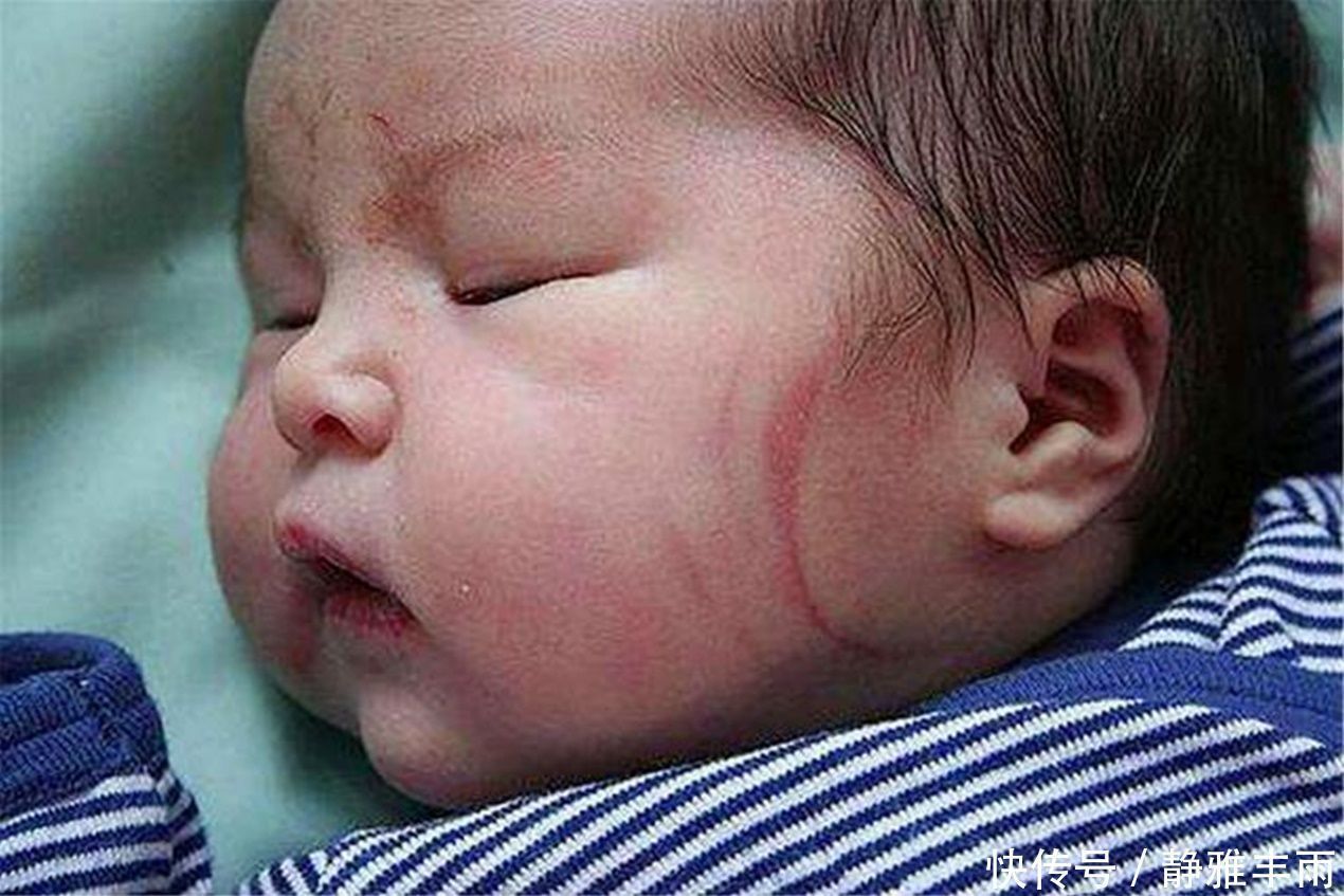 宝妈|当年的校花校草,如今生下丑宝宝,医生:别看了,就是你们亲生的