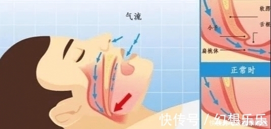 养肝|凌晨两三点准点醒，不是失眠这么简单，或是肝脏出了问题，别忽视