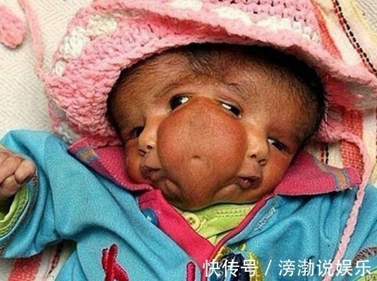 怀孕|怀孕20周,四维彩超却发现胎儿畸形,闻到孕妇身上的味道明白了