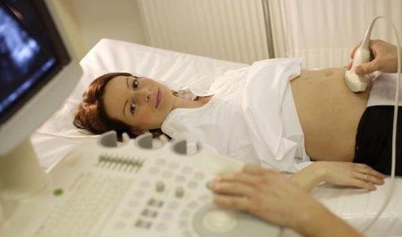 畸形史|最容易出现胎儿畸形的5类妈妈,有你吗?早知道早预防!