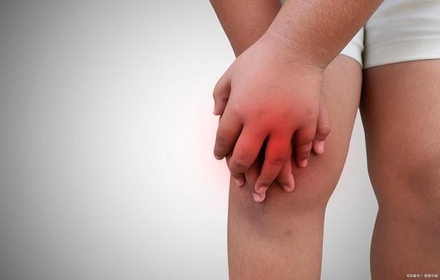 疾病|痛风和风湿性关节炎根本不是同一回事，本文来细数它们之间的区别