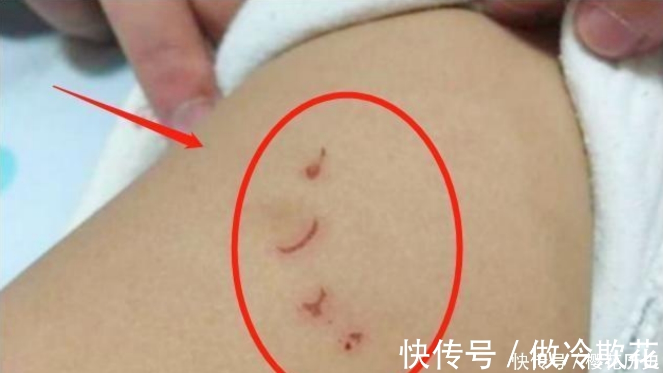 哥哥|哥哥一亲近妹妹,妹妹却莫名哭闹,妈妈掀开妹妹衣服失声痛哭