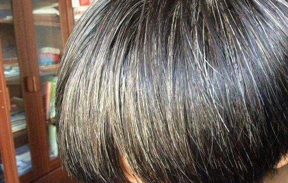 补肾|少白头千古第一方！两味药，补肾+凉血，让头发慢慢黑起来