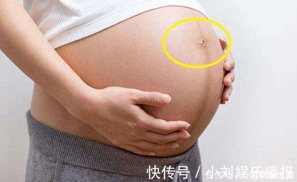 怀孕期间|女性怀孕后,肚脐眼是凸起是凹进,受3个因素影响,别轻易忽视