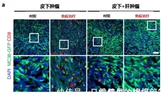 肝转移|让肺癌治疗失效的元凶竟然是它！逆转方法如此简单—抗癌管家