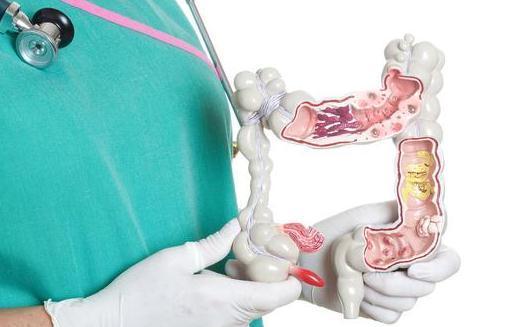 息肉|直径5毫米的肠息肉,变成肠癌要多长时间?是不是割掉就没事了?