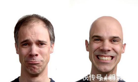 延缓衰老|男人衰老有这5个表现,要是1个也没有,说明你还年轻!