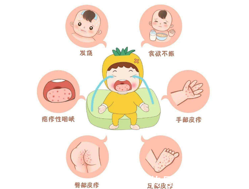 宝宝|原本以为夏季才是手足口病的高发期,没想到冬季也是