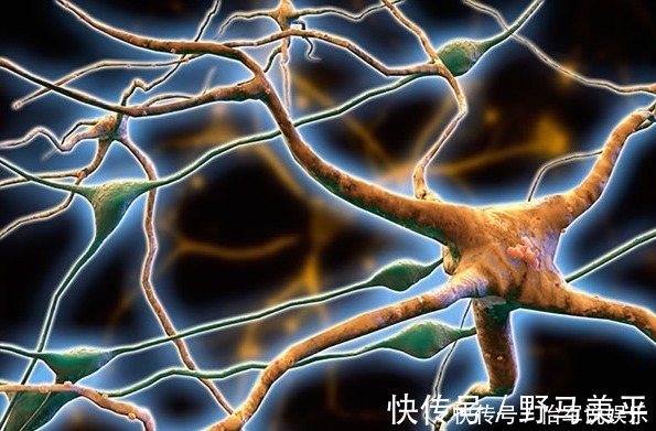 脑细胞|为什么有的老人一到70岁,过不了几年就会逝去?原因主要有这三点